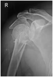 orthopedic hospital in paldi